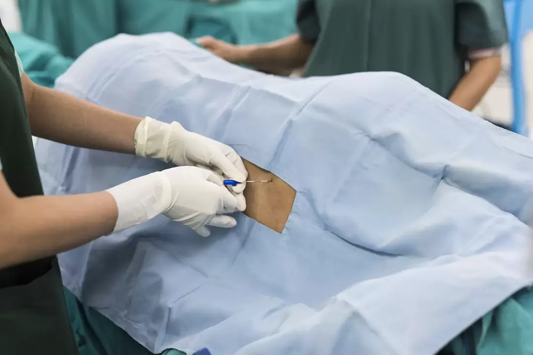 sting for back pain